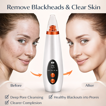 6 in 1 Blackheads Remover Electric Device